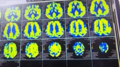 Çin Ulusal Tıbbi Ürünler Denetim İdaresi (NMPA), Neuracle Medical Technology