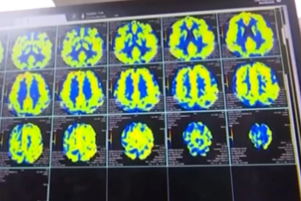 Çin Ulusal Tıbbi Ürünler Denetim İdaresi (NMPA), Neuracle Medical Technology